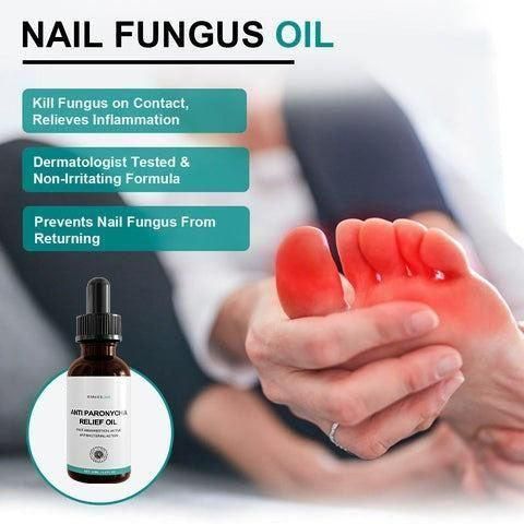 Anti Paronychia Nail Fungus Oil (Pack of 1) – Hopshop 98